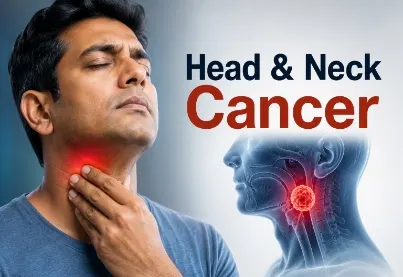 Head and Neck Cancer Care